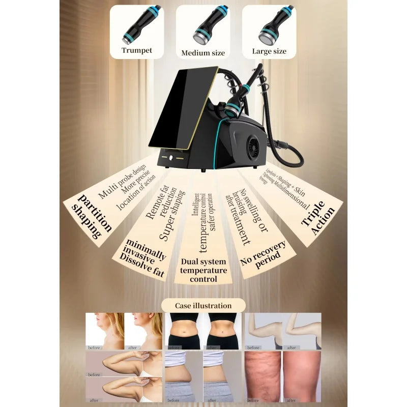 2025 NEW Onda Ice-Microwave 2.45GHz Skin Tightening Machine for Body Contouring and Anti-Cellulite Treatment Beauty Machine